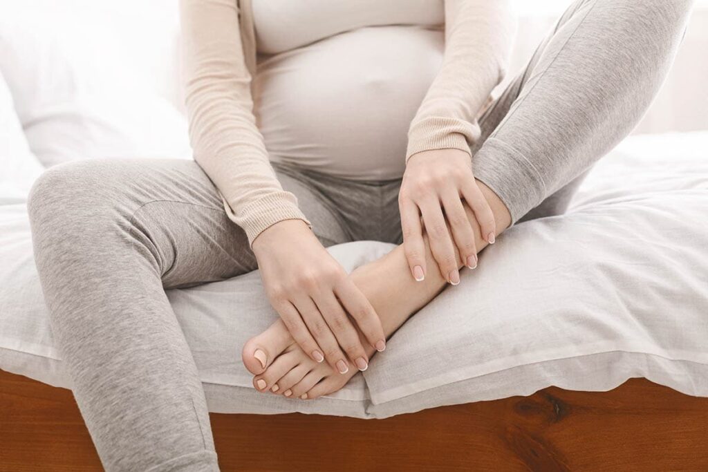 Κιρσοί (φλεβική ανεπάρκεια) και εγκυμοσύνη